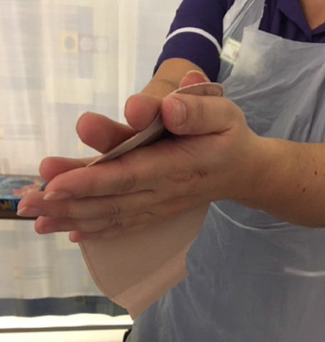 Photo showing how to warm the baseplate to help it adhere to the skin