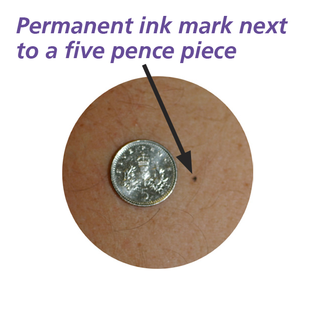 Photograph of a five pence piece next to the permanent ink mark.