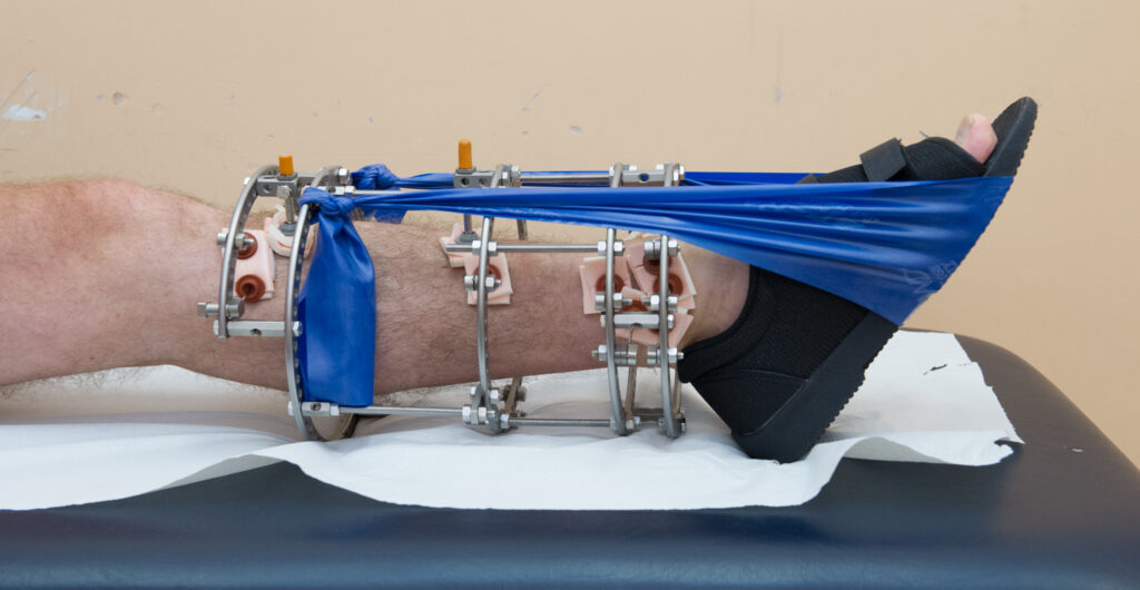 Photograph demonstrating Resisted Ankle Movement exercise.
Keeping knee straight, push your foot down against the theraband and then slowly release. 
Repeat until your calf muscle feels tired.
