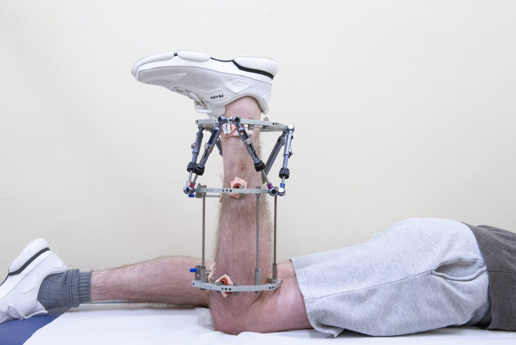 Photograph demonstrating Hamstring Curl exercise.
Lie on your front and bend your knee to about 90 degrees, gently return to straightened position.
Repeat 30 times.
To advance this exercise, add an ankle weight.