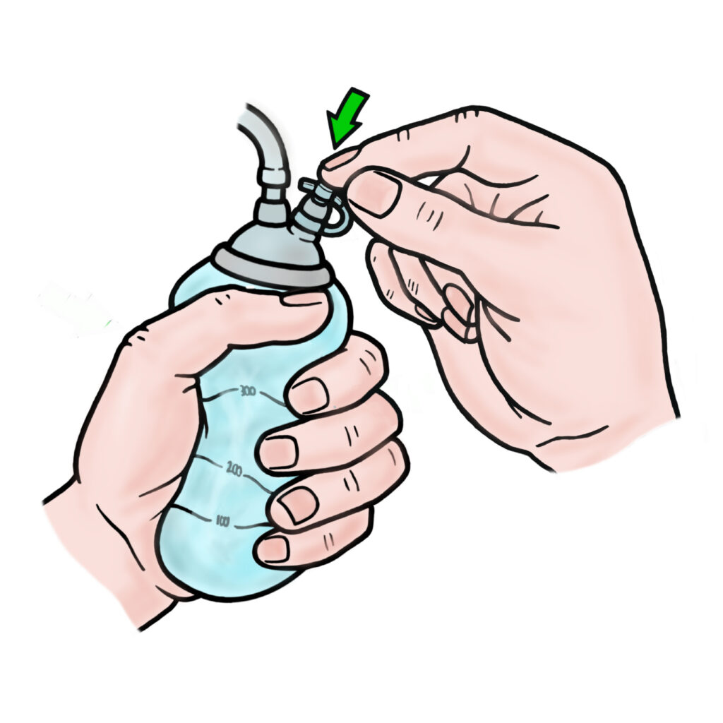 With your other hand, reapply the cap. 
This will make sure the suction is in place to allow the lymph fluid to drain from your body.