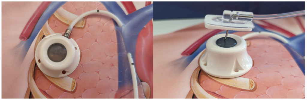 A pair of images showing how a needle accesses the hub.