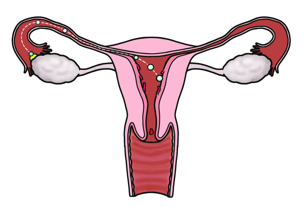 Illustration of the womb tubes ovaries cervix vagina showing the journey of the egg from the ovary to the womb, and the breakdown of the lining of the womb when the egg is not fertilised (the period).