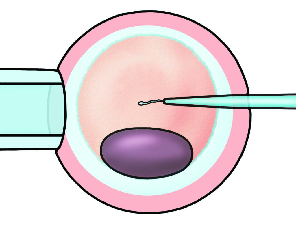 Illustration showing an egg being injected with a sperm to fertilise it.