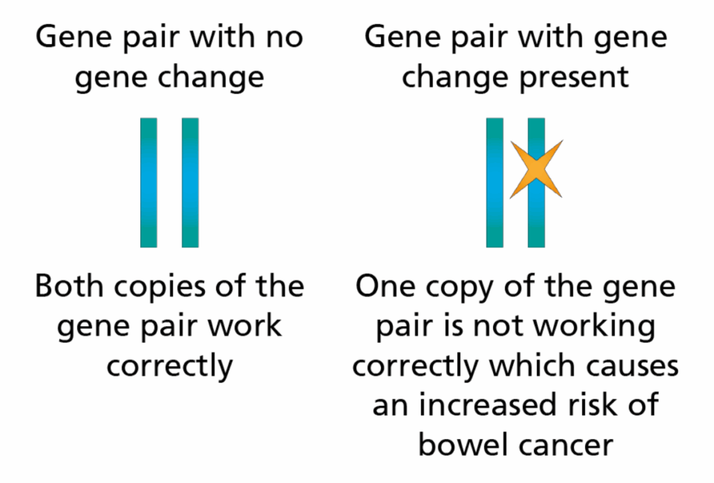 Picture shows a gene pair with no changes and also a gene pair with a gene change present. One gene is not working correctly which causes an increased risk of bowel cancer