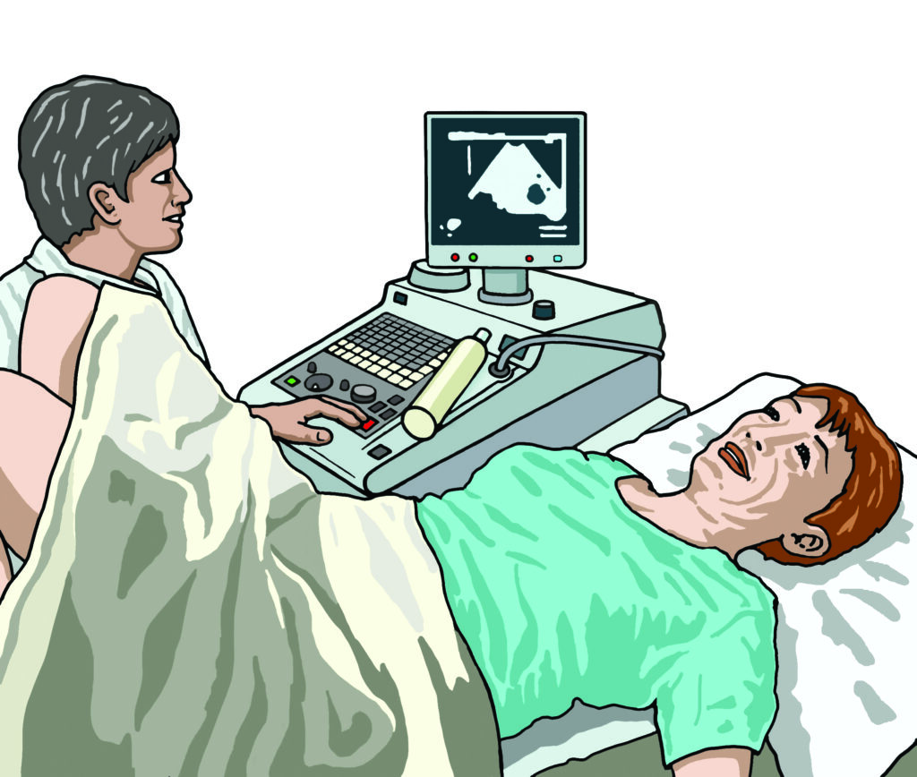 Illustration of a patient having a vaginal scan performed.
