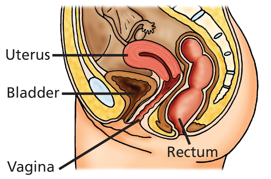 Illustration showing Anatomy without prolapse.