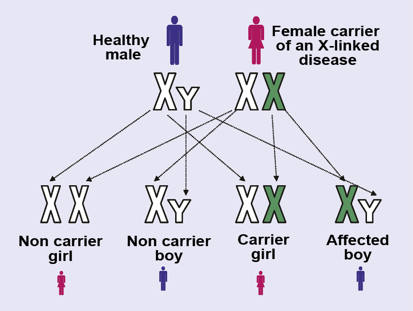 Illustration showing a healthy male and a female carrier of an X-linked disease and the chances of their children inheriting the X chromosome.