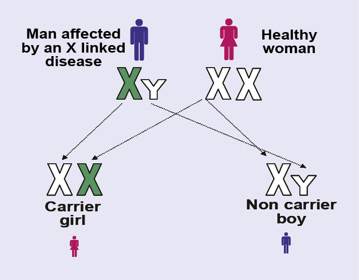 Illustration showing a male affected by an X linked disease and a healthy female and how their male and female children would be affected.