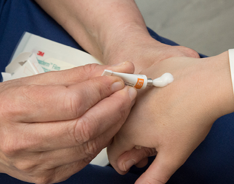 Photograph of some numbing cream being applied to the back of a hand.