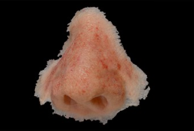Nasal prosthesis