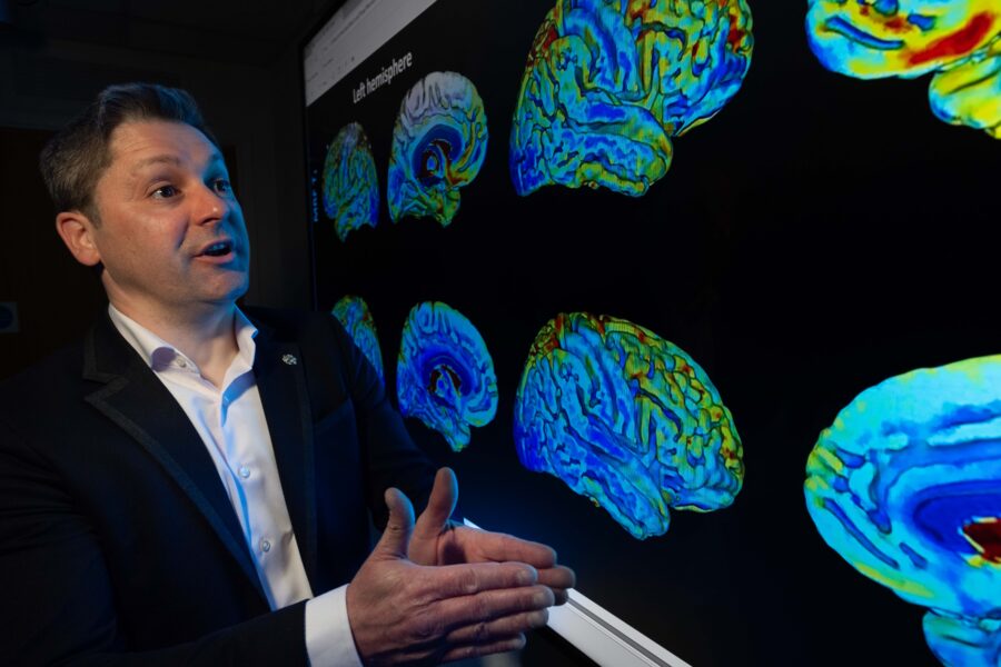 MND research 2
